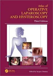 Atlas of Operative Laparoscopy and Hysteroscopy, Third Edition (Repost)