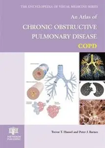 An Atlas of Chronic Obstructive Pulmonary Disease (Repost)