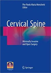 Cervical Spine: Minimally Invasive and Open Surgery (Repost)