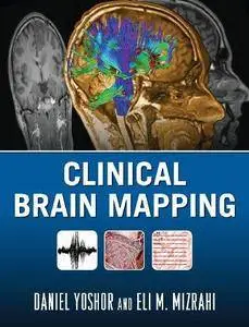 Clinical Brain Mapping (Repost)