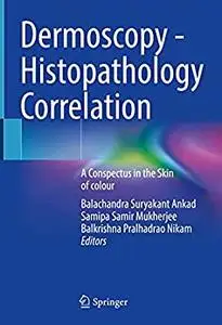 Dermoscopy - Histopathology Correlation: A Conspectus in the Skin of colour