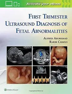 First Trimester Ultrasound Diagnosis of Fetal Abnormalities [Repost]