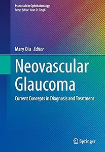 Neovascular Glaucoma: Current Concepts in Diagnosis and Treatment (Essentials in Ophthalmology)