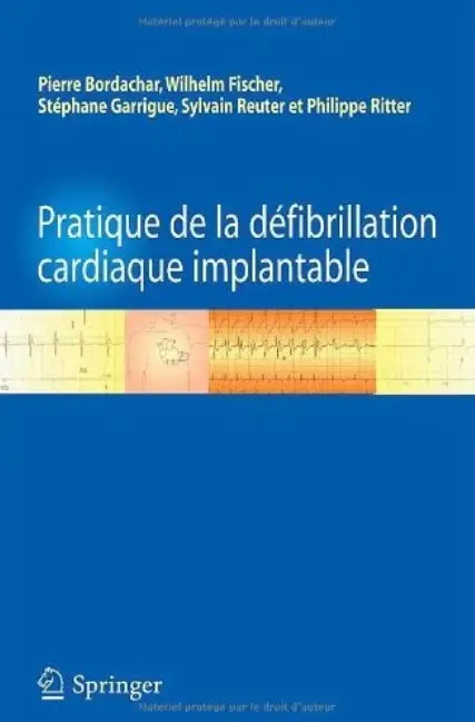 Pratique de la défibrillation cardiaque implantable