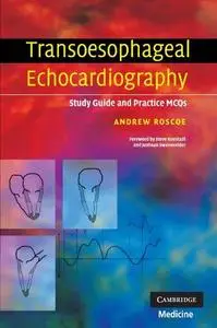 Transoesophageal Echocardiography: Study Guide and Practice MCQs