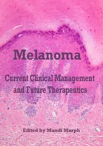 "Melanoma: Current Clinical Management and Future Therapeutics" ed. by Mandi Murph