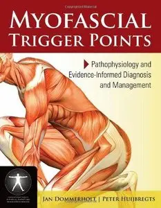 Myofascial Trigger Points: Pathophysiology and Evidence-informed Diagnosis and Management 