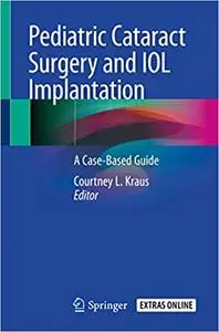 Pediatric Cataract Surgery and IOL Implantation: A Case-Based Guide