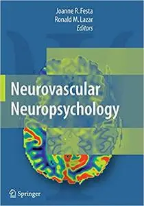 Neurovascular Neuropsychology (Repost)