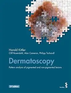 Dermatoscopy: Pattern analysis of pigmented and non-pigmented lesions