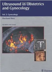 Ultrasound in Obstetrics and Gynecology: Volume 2: Gynecology (2nd edition) [Repost]