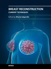 Breast Reconstruction – Current Techniques by Marzia Salgarello