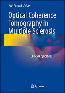 Optical Coherence Tomography in Multiple Sclerosis: Clinical Applications (Repost)