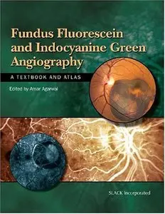 Fundus Fluorescein and Indocyanine Green Angiography: A Textbook and Atlas