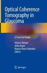Optical Coherence Tomography in Glaucoma: A Practical Guide (Repost)