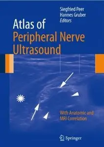 Atlas of Peripheral Nerve Ultrasound: With Anatomic and MRI Correlation [Repost]