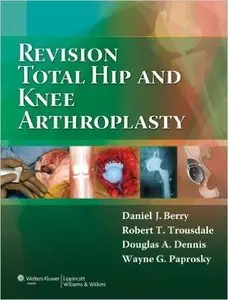 Revision Total Hip and Knee Arthroplasty (Repost)