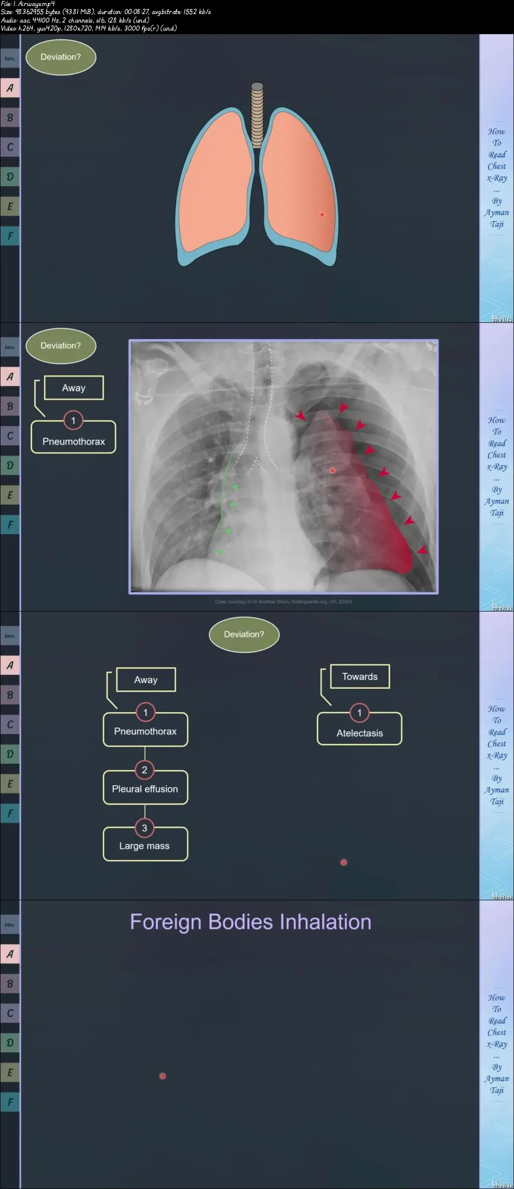 How to Read Chest XRay From Zero to Hero / AvaxHome