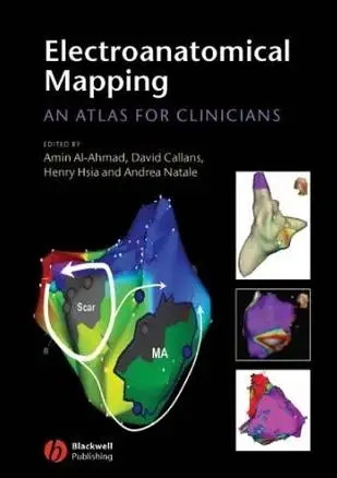 Electroanatomical Mapping: An Atlas for Clinicians