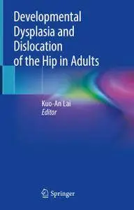 Developmental Dysplasia and Dislocation of the Hip in Adults