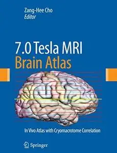 7.0 Tesla MRI Brain Atlas: In Vivo Atlas with Cryomacrotome Correlation