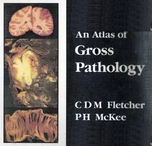An Atlas of Gross Pathology by Christopher D. M. Fletcher [Repost]