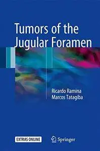 Tumors of the Jugular Foramen (Repost)