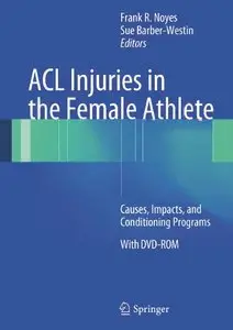 ACL Injuries in the Female Athlete: Causes, Impacts, and Conditioning Programs (repost)