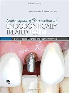 Contemporary Restoration of Endodontically Treated Teeth: Evidence-Based Diagnosis and Treatment Planning (Repost)