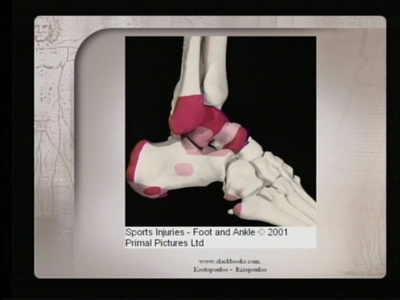 Comprehensive Manual Therapy for the Lower Extremity on DVD