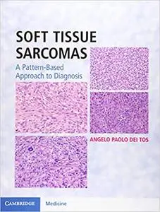 Soft Tissue Sarcomas Hardback with Online Resource: A Pattern-Based Approach to Diagnosis (Repost)