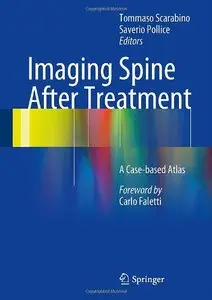 Imaging Spine After Treatment: A Case-based Atlas