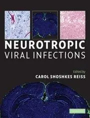 Neurotropic viral infections
