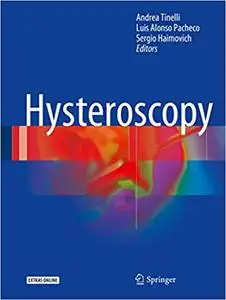 Hysteroscopy (repost)