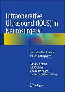 Intraoperative Ultrasound (IOUS) in Neurosurgery: From Standard B-mode to Elastosonography