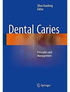 Dental Caries: Principles and Management