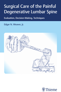 Surgical Care of the Painful Degenerative Lumbar Spine : Evaluation, Decision-Making, Techniques