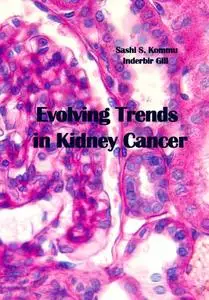 "Evolving Trends in Kidney Cancer" ed. by Sashi S. Kommu, Inderbir Gill