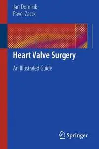 Heart Valve Surgery: An Illustrated Guide