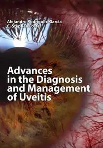 "Advances in the Diagnosis and Management of Uveitis" ed. by Alejandro Rodriguez-Garcia, C. Stephen Foster