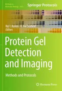 Protein Gel Detection and Imaging: Methods and Protocols