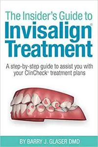 The Insider's Guide to Invisalign Treatment: A step-by-step guide to assist your ClinCheck treatment plan