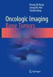 Oncologic Imaging: Bone Tumors