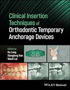 Clinical Insertion Techniques of Orthodontic Temporary Anchorage Devices