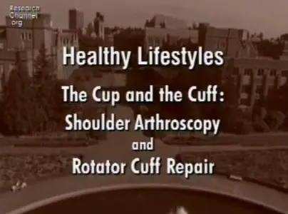 Video of "Shoulder Arthroscopy & Rotator Repair" 2009