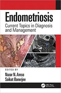 Endometriosis: Current Topics in Diagnosis and Management