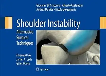 Shoulder Instability: Alternative Surgical Techniques