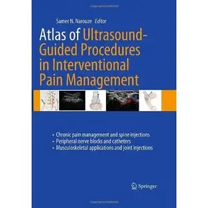 Atlas of Ultrasound-Guided Procedures in Interventional Pain Management by Samer N. Narouze