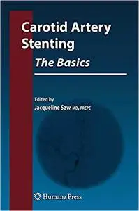 Carotid Artery Stenting: The Basics