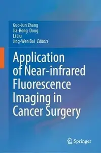 Application of Near-infrared Fluorescence Imaging in Cancer Surgery